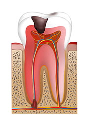 nerve_process1.jpg