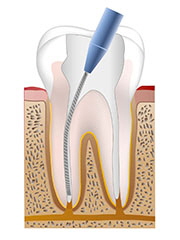 nerve_process2.jpg