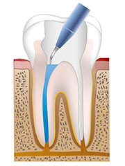 nerve_process3.jpg