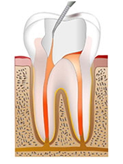 nerve_process4.jpg