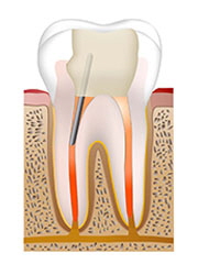 nerve_process5.jpg