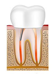 nerve_process6.jpg